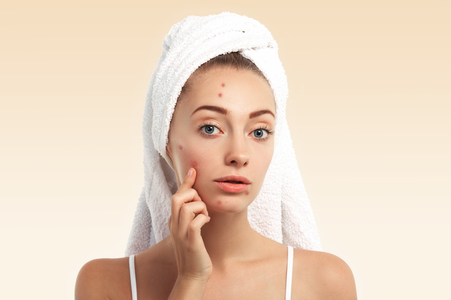 Pigmentation Treatment